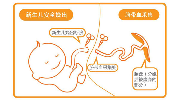 脐带血怎么储存